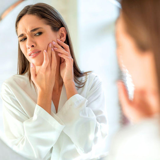 Is It Ever Beneficial To Pop a Pimple? We Uncover The Truth! - NaturaXotic